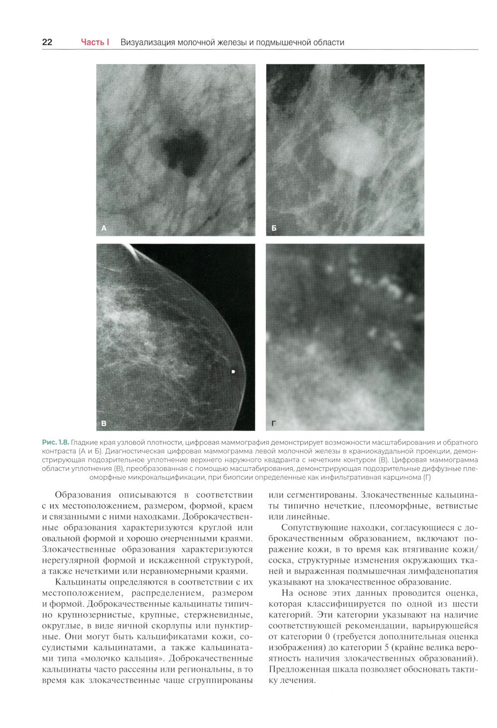 Хирургия молочной железы