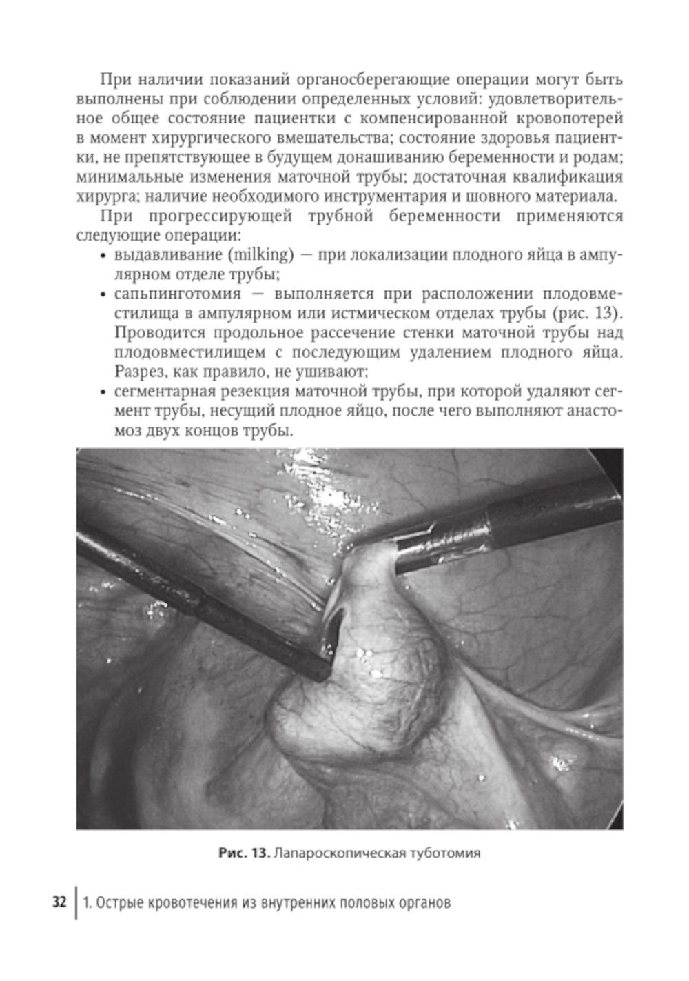 Острый живот в гинекологии: руководство для врачей