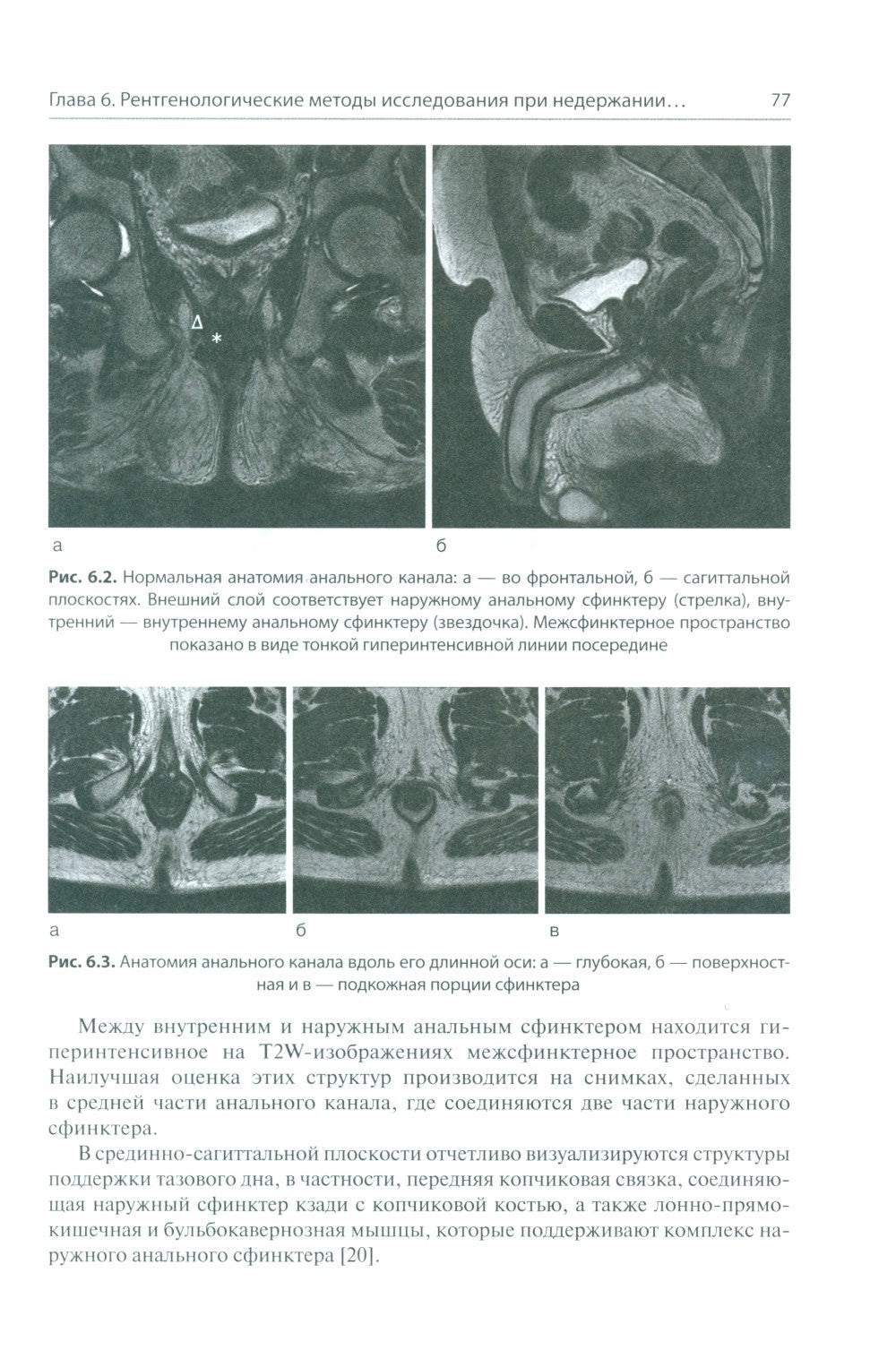 Анальная инконтиненция. Клиническое ведение и хирургическая тактика