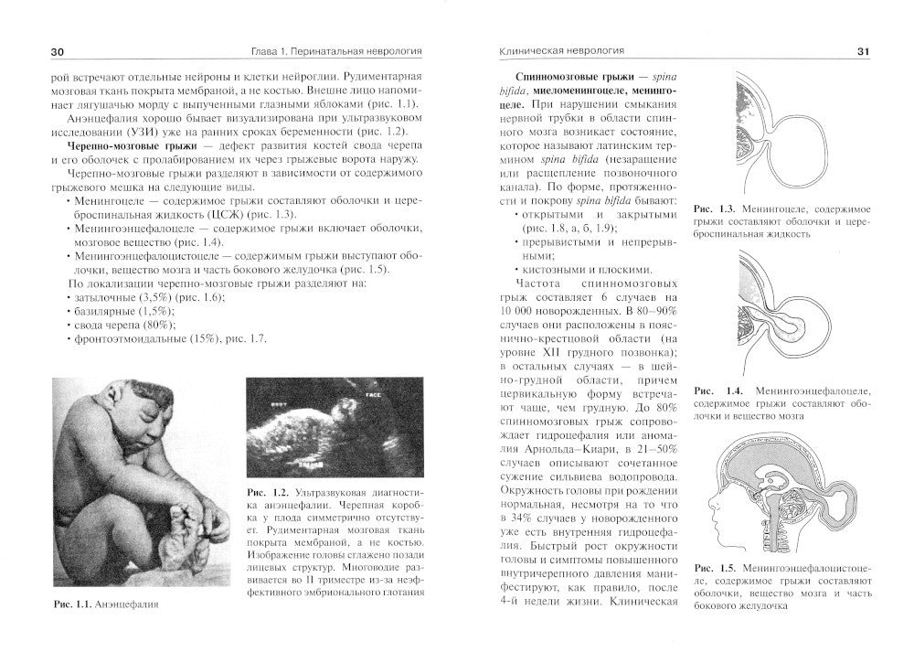 Детская неврология и нейрохирургия: Учебник. В 2 т. Т. 2