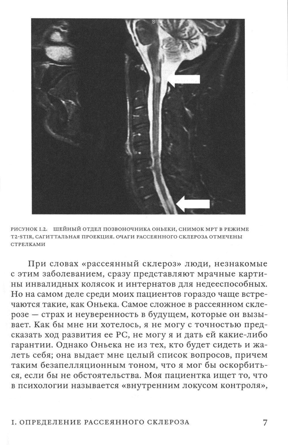 Поговорим о рассеянном склерозе: Семь шагов к преодолению болезни