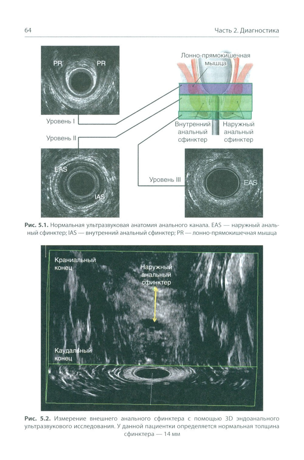 Анальная инконтиненция. Клиническое ведение и хирургическая тактика