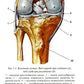 Лучевая диагностика повреждений коленного сустава (Конспект лучевого диагност...