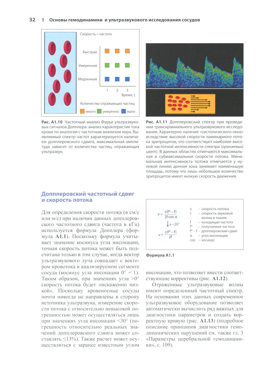 Нейросонология и нейровизуализация при инсульте. 3-е изд
