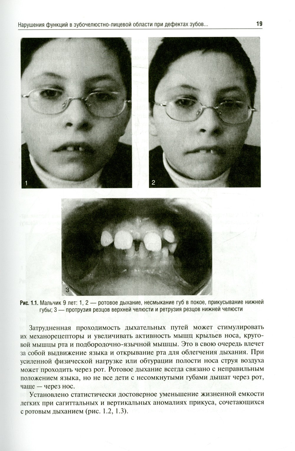 Ортодонтия. Диагностика и функциональные методы профилактики и лечения зубоче...