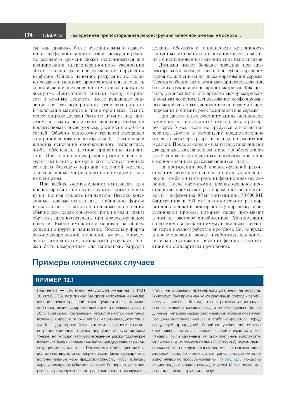 Атлас реконструктивной хирургии молочной железы