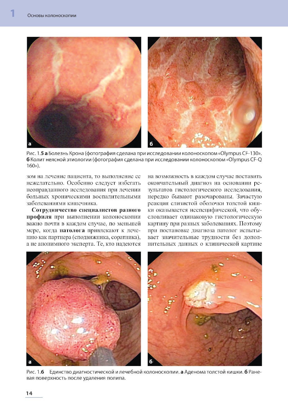 Практическая колоноскопия. Методика, рекомендации, советы и приемы. 3-е изд