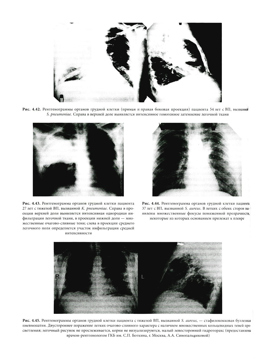 Основы внутренней медицины. В 2 т., в 2 кн. (комплект из 2-х кн.): Руководств...