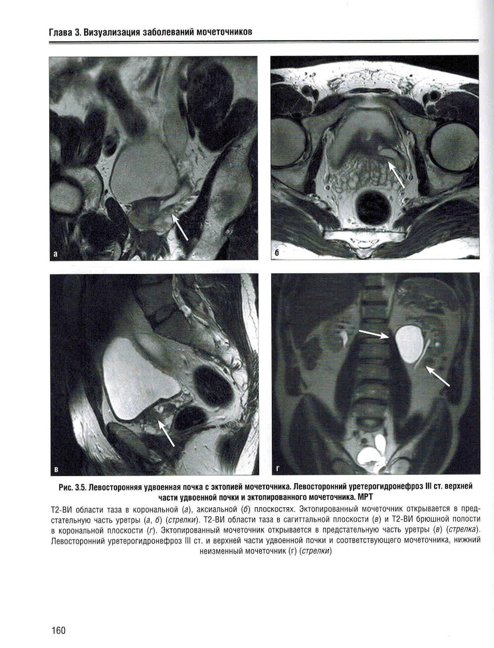 Визуализация заболеваний почек, мочеточников и мочевого пузыря: Учебное пособие
