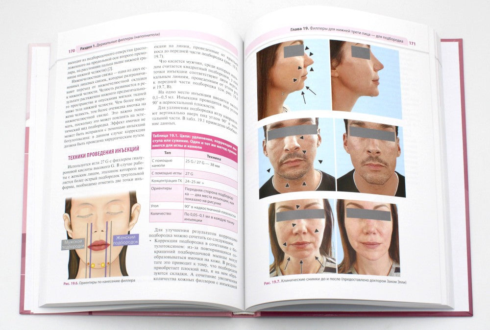Практическое применение косметических инъекционных препаратов. Дермальные фил...