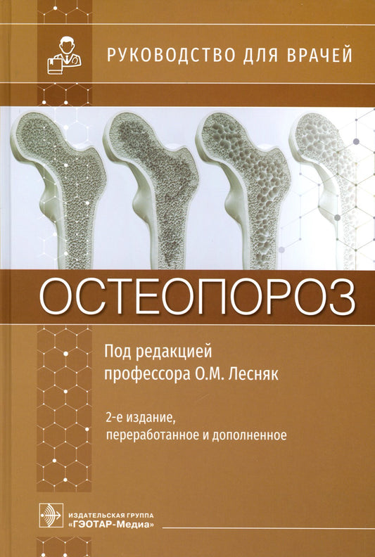 Остеопороз: руководство для врачей. 2-е изд., перераб. и доп