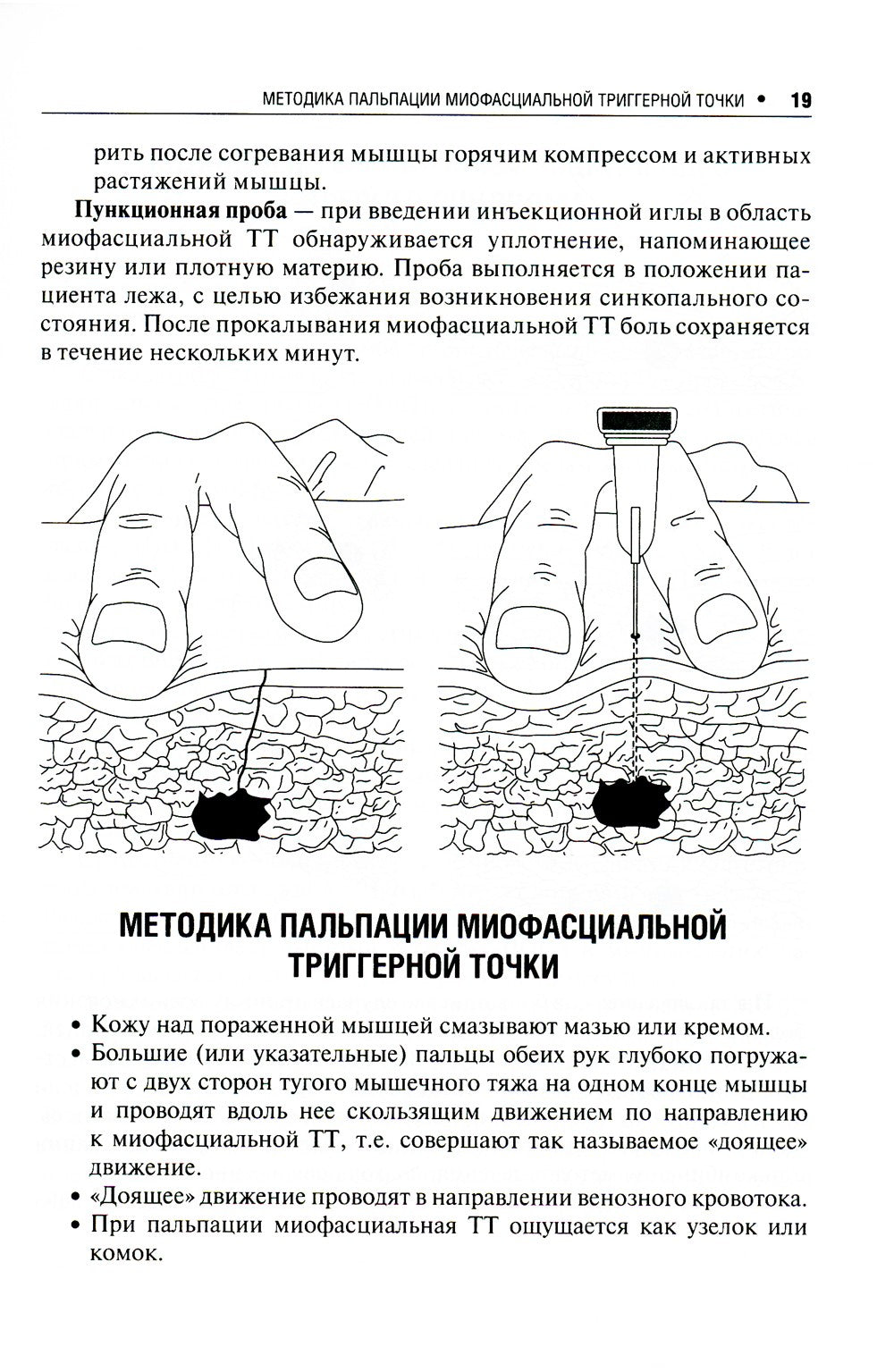 Миофасциальный болевой синдром. Диагностика, подходы к терапии и профилактика...