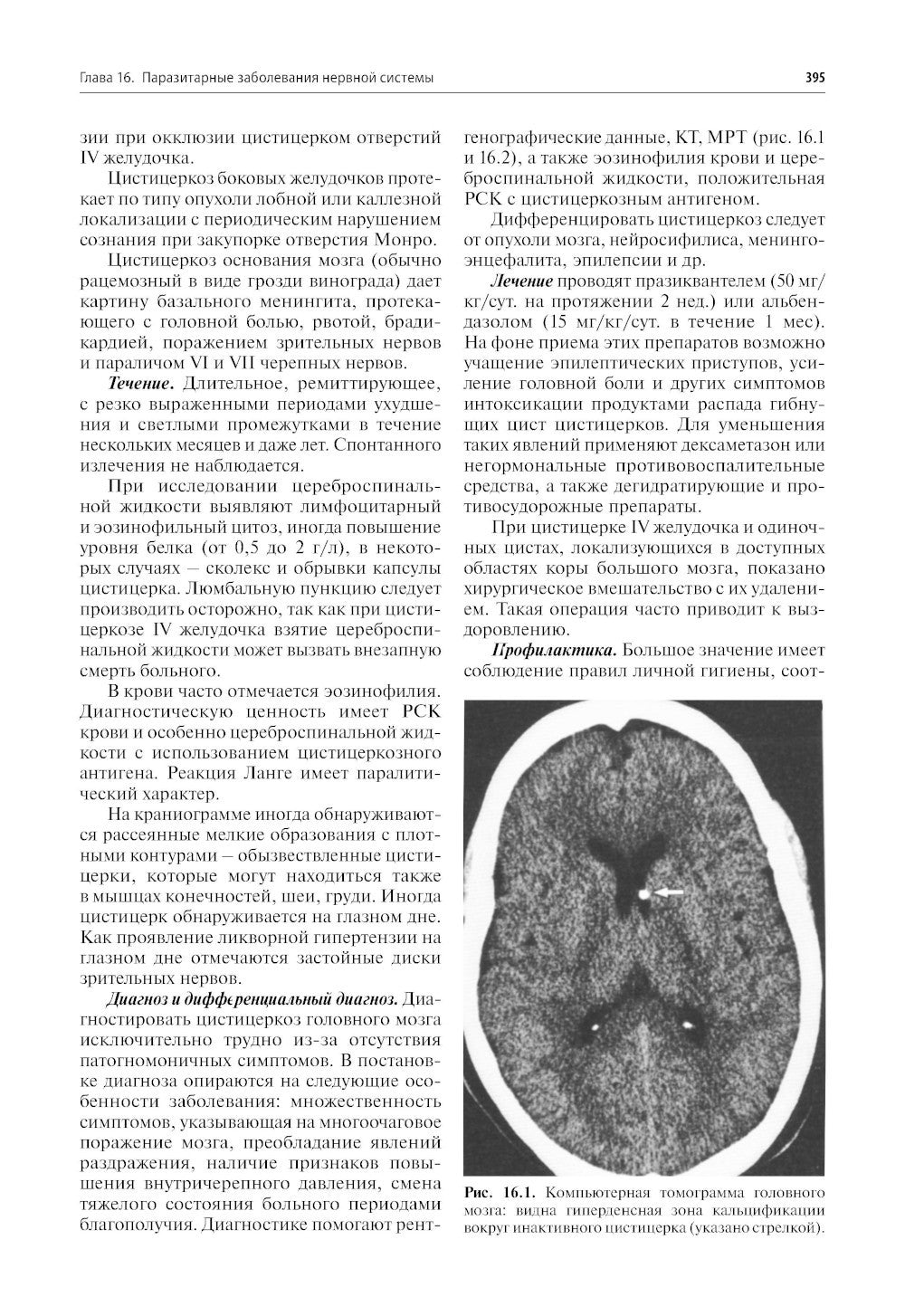 Нервные болезни: Учебник. 13-е изд