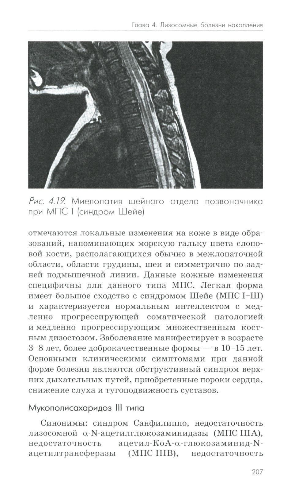 Нейрометаболические заболевания у детей и подростков: диагностика и подходы к...