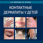 Контактные дерматиты у детей