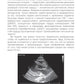 Эхокардиография для начинающих. 2-е изд., перераб. и доп