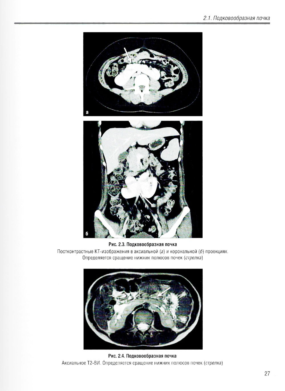 Визуализация заболеваний почек, мочеточников и мочевого пузыря: Учебное пособие