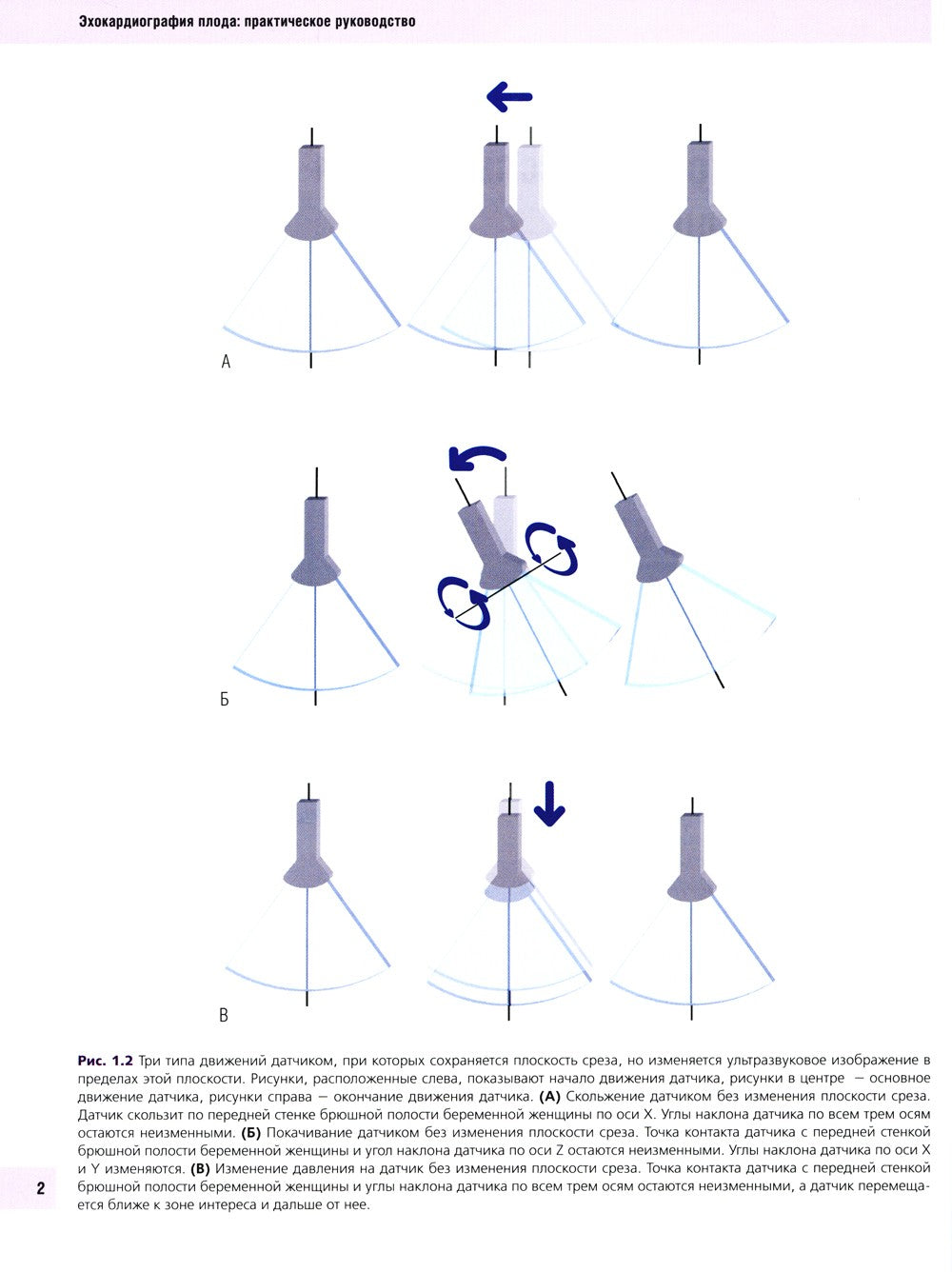 Эхокардиография плода: практическое руководство. + DVD