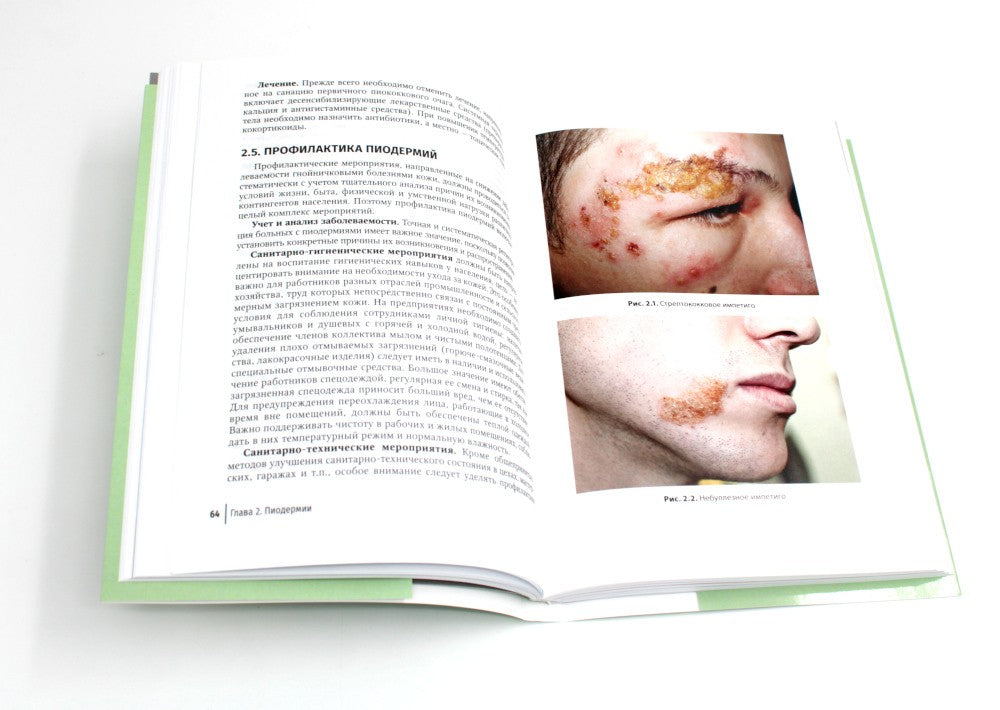 Инфекционные болезни кожи