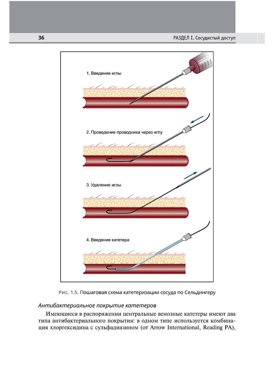 Интенсивная терапия. 2-е изд