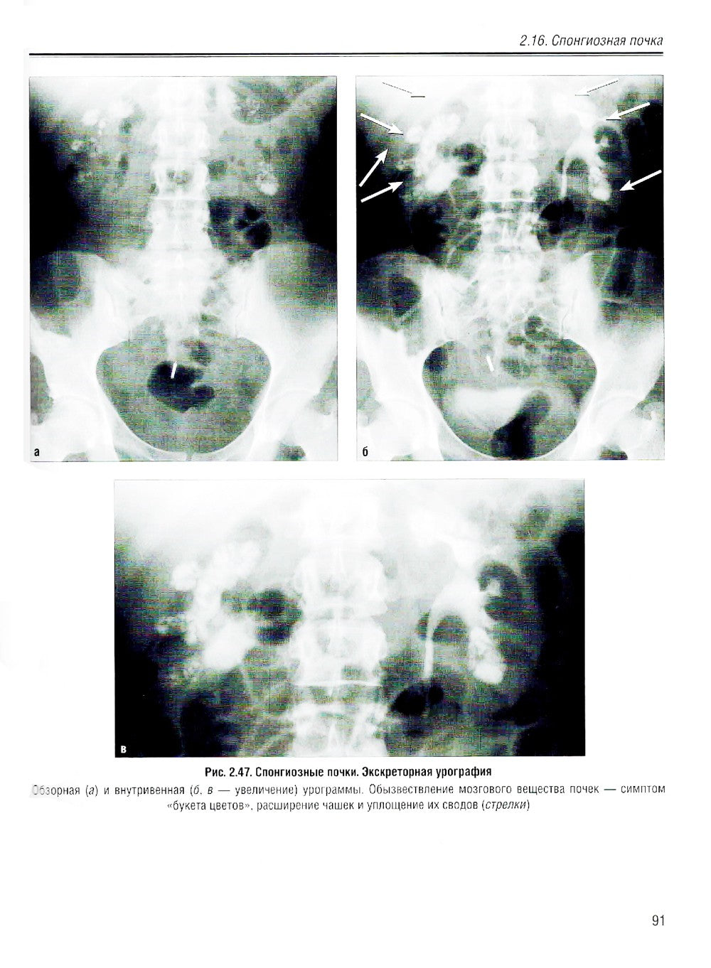 Визуализация заболеваний почек, мочеточников и мочевого пузыря: Учебное пособие