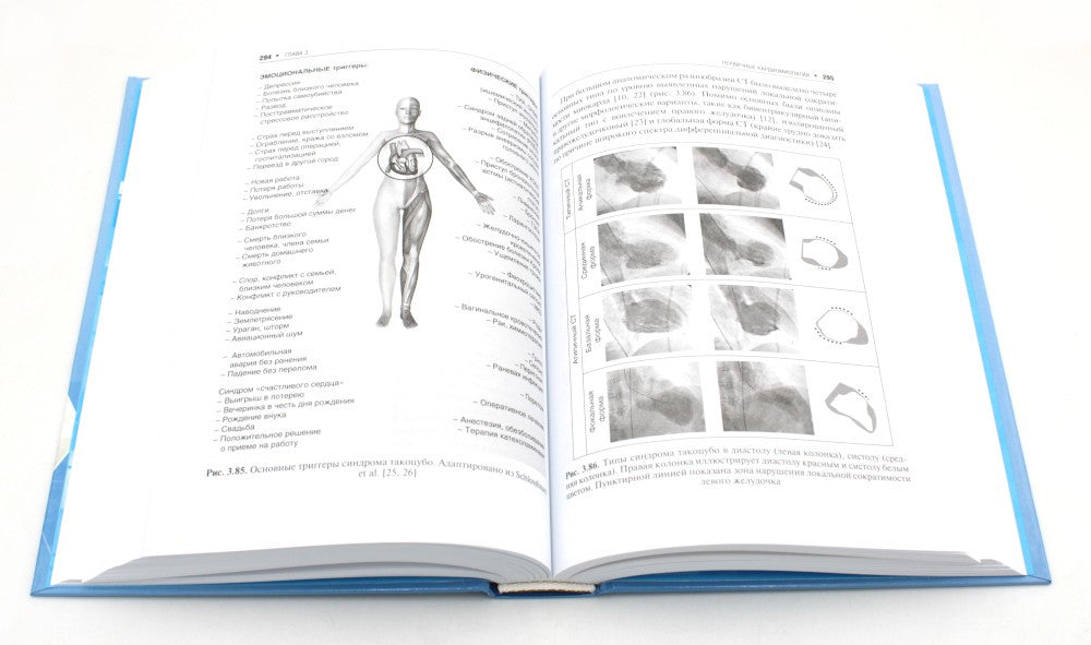 Кардиомиопатии и миокардиты. 2-е изд., перераб. и доп