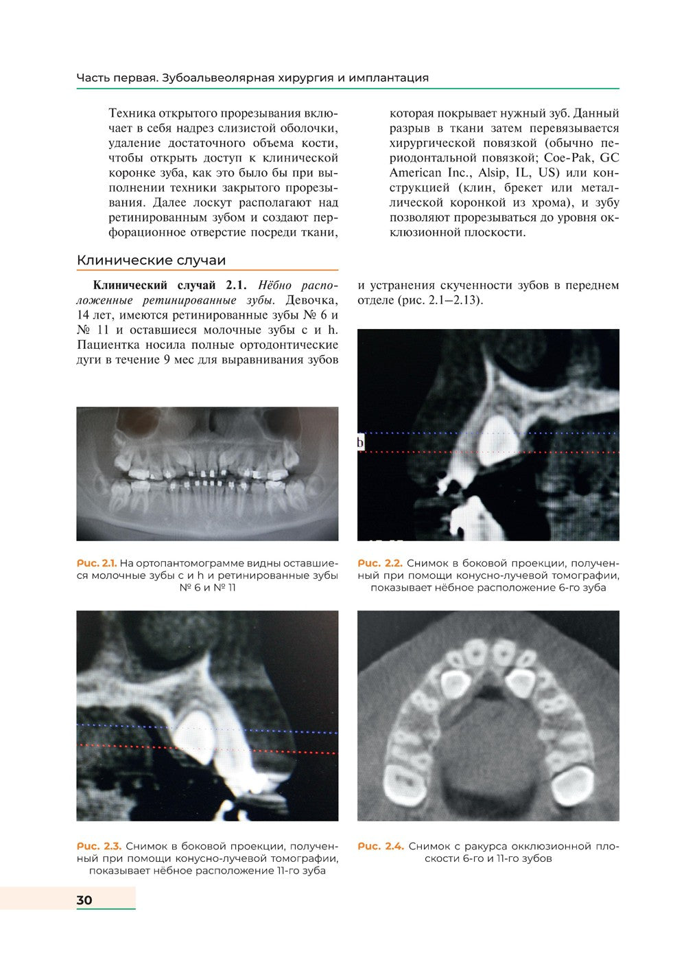 Оперативная хирургия полости рта и челюстно-лицевой области. Атлас