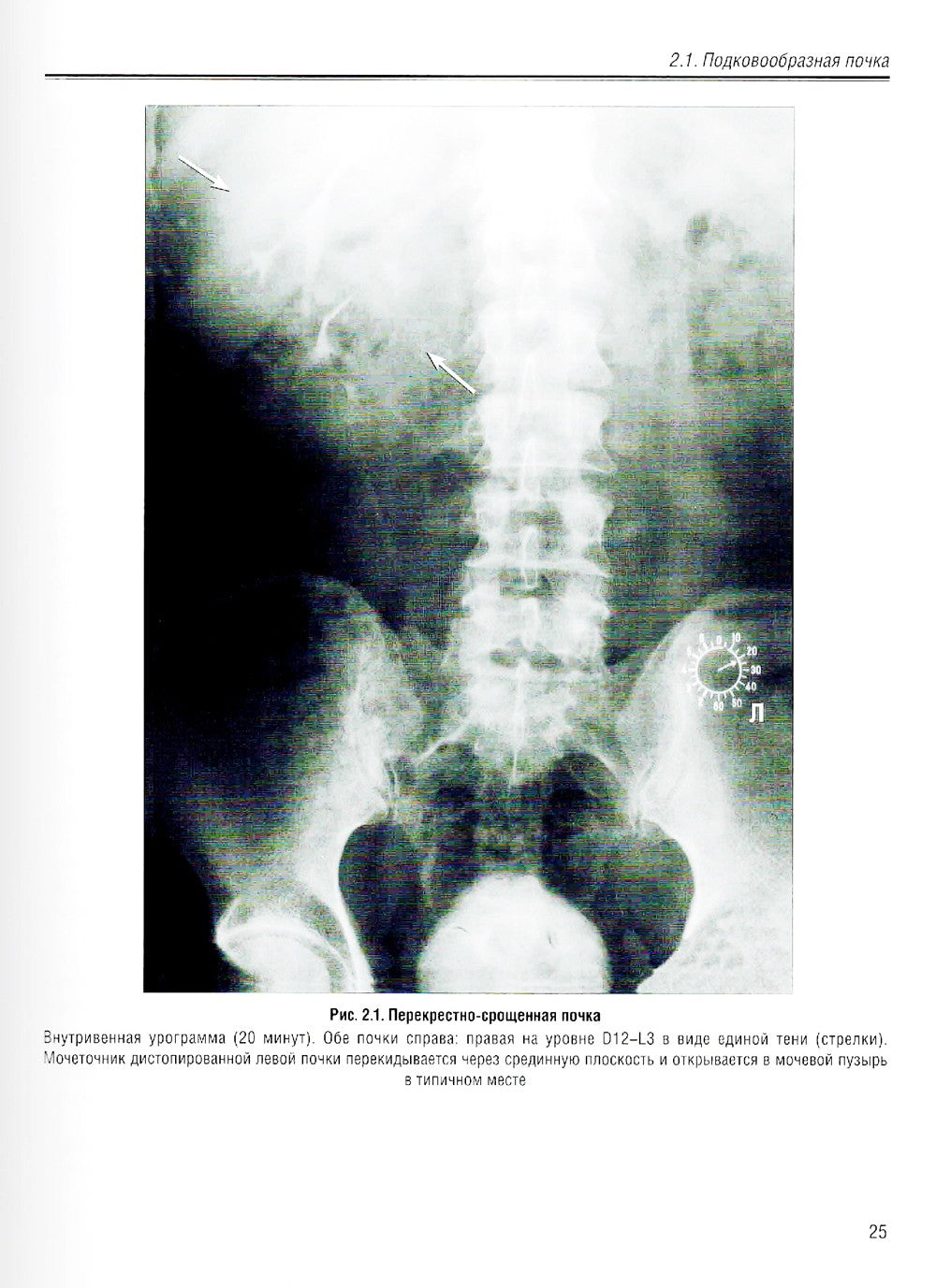 Визуализация заболеваний почек, мочеточников и мочевого пузыря: Учебное пособие