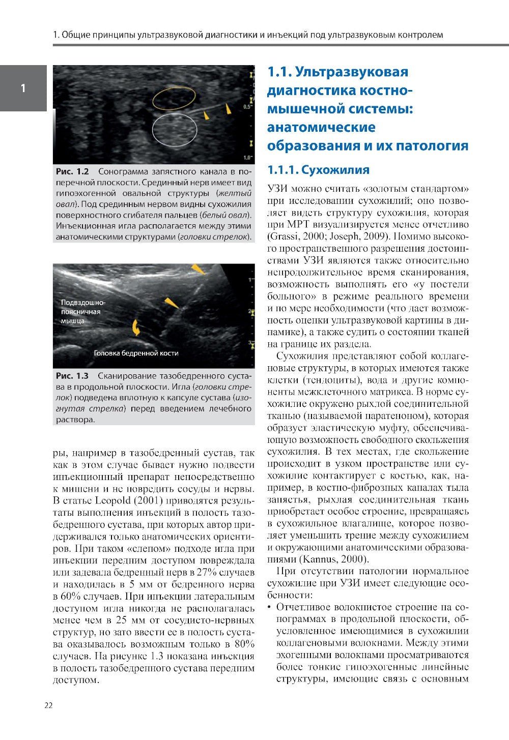 Ультразвуковая диагностика болезней костно-мышечной системы и инъекции под ул...