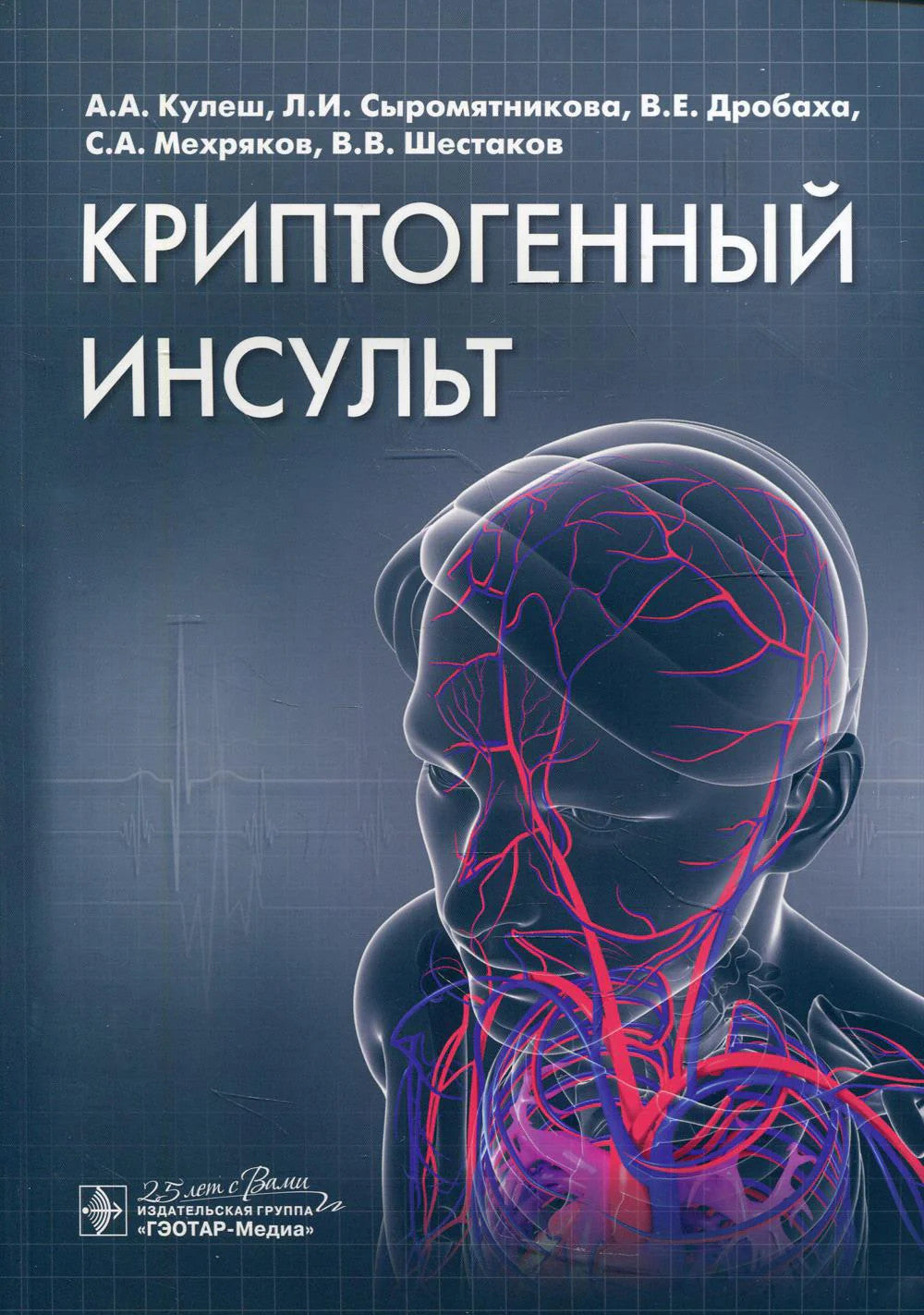 Криптогенный инсульт: руководство