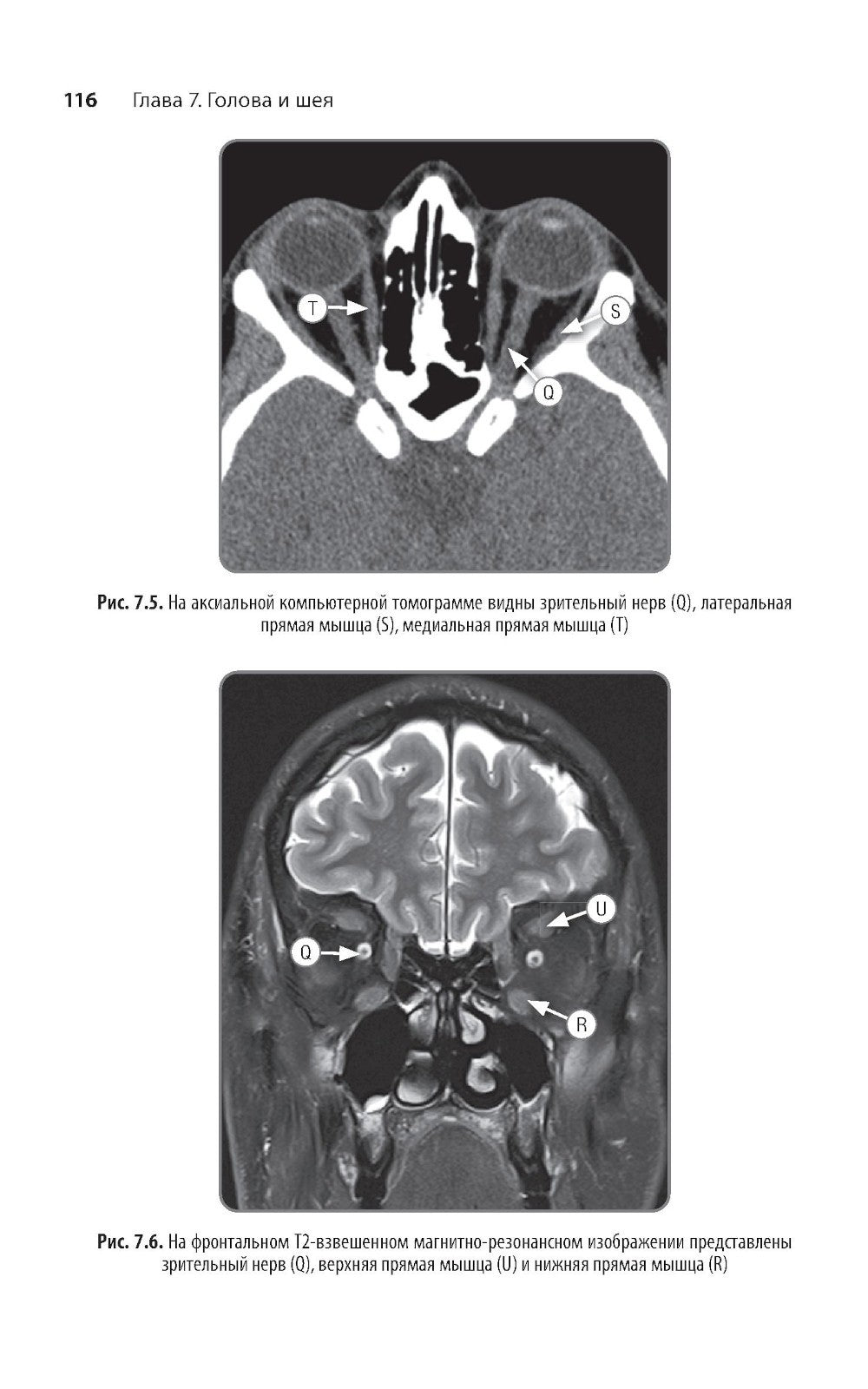 Неотложная радиология: карманный справочник