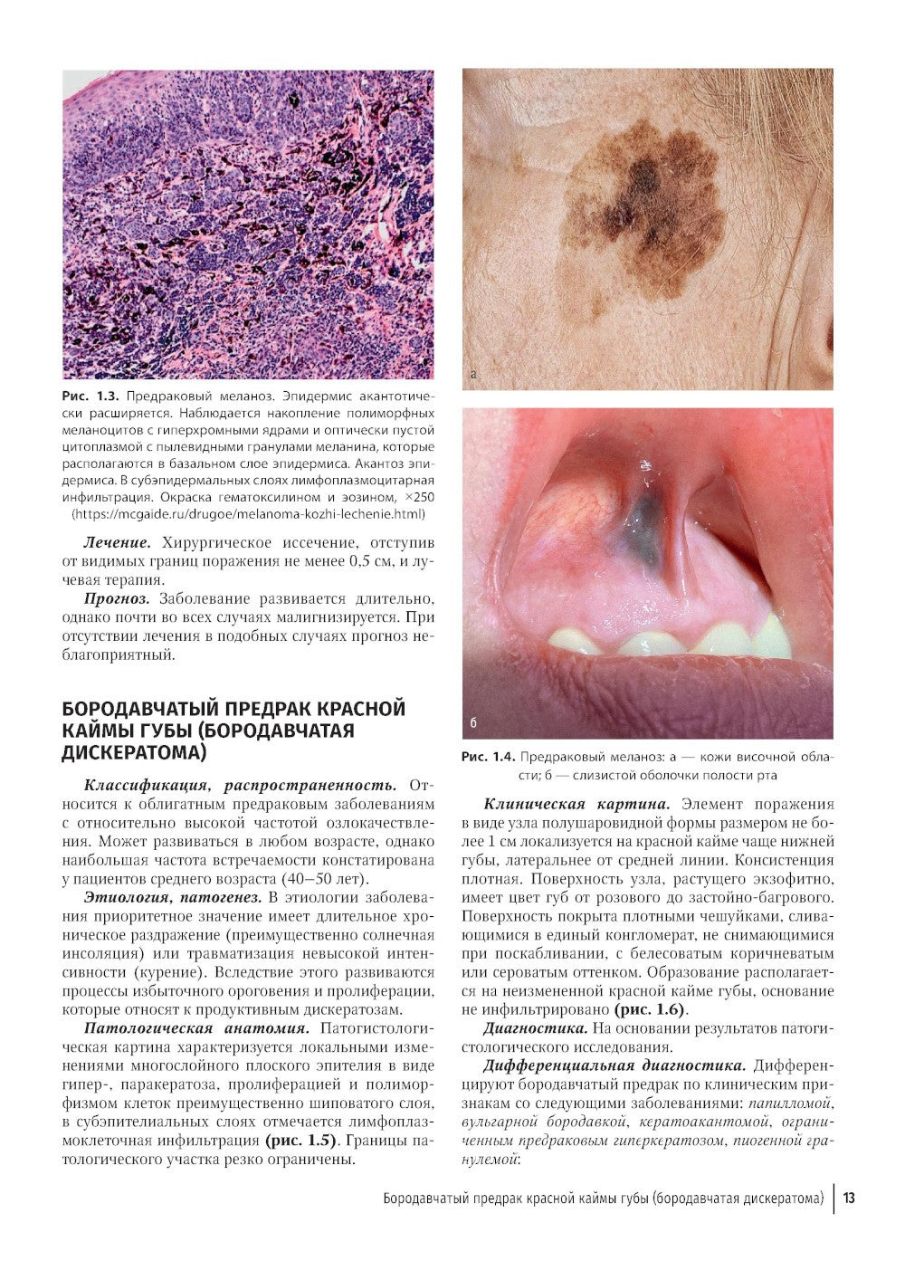 Атлас диагностики заболеваний челюстно-лицевой области