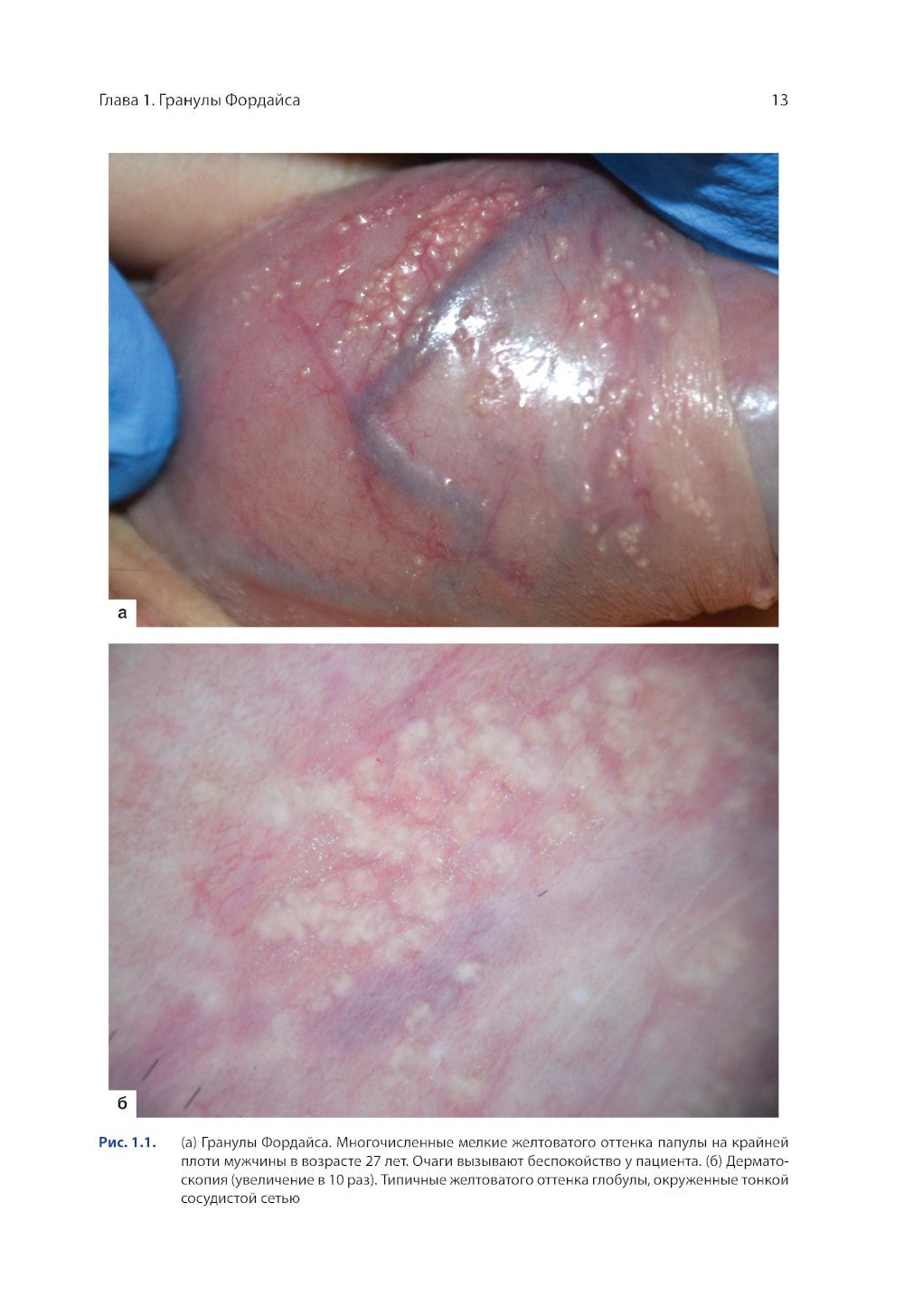 Атлас генитальной дерматоскопии