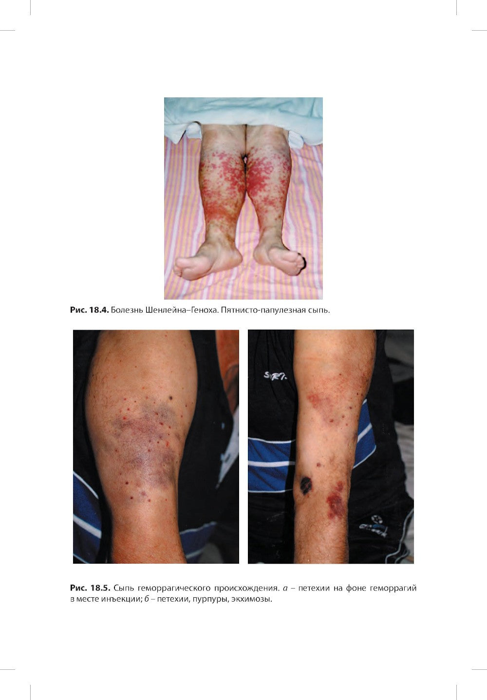 Пропедевтика детских болезней с уходом за детьми: Учебник для вузов. 7-е изд