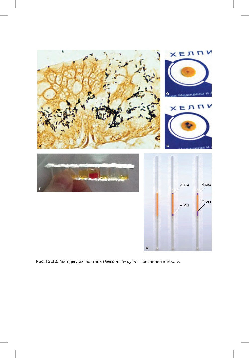 Пропедевтика детских болезней с уходом за детьми: Учебник для вузов. 7-е изд