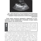 Эхокардиография для начинающих. 2-е изд., перераб. и доп