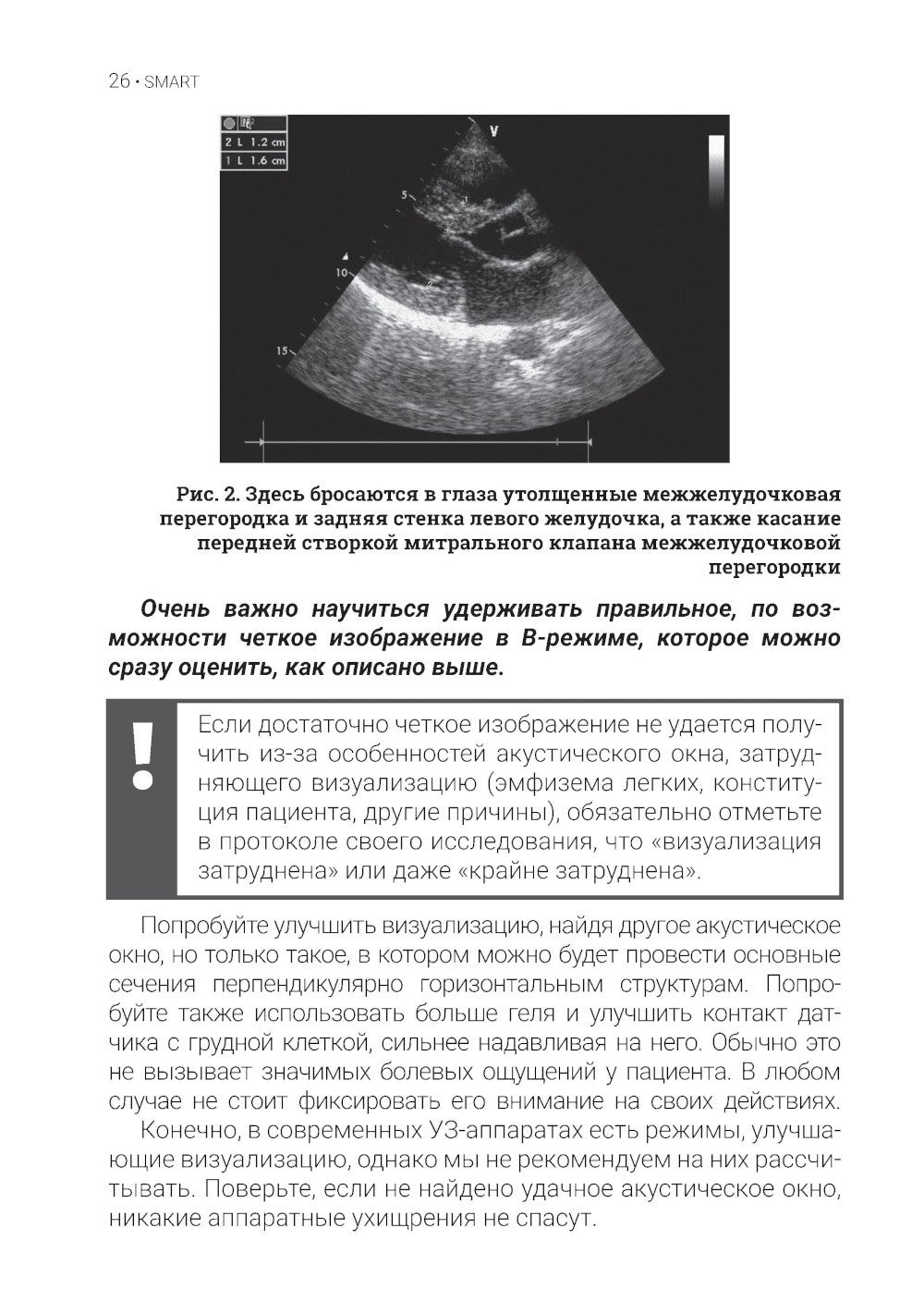 Эхокардиография для начинающих. 2-е изд., перераб. и доп