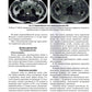 Визуализация заболеваний почек, мочеточников и мочевого пузыря: Учебное пособие
