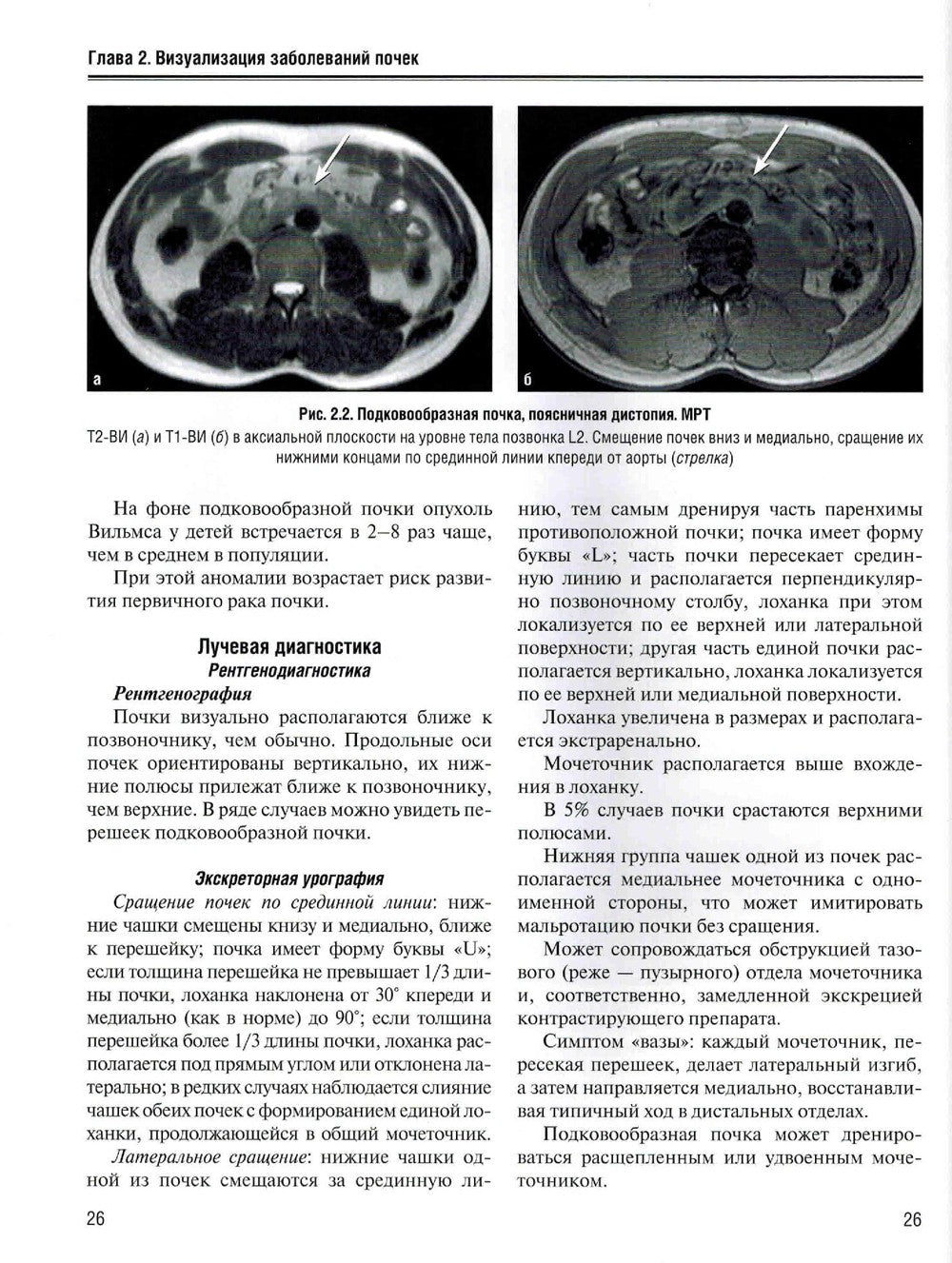 Визуализация заболеваний почек, мочеточников и мочевого пузыря: Учебное пособие