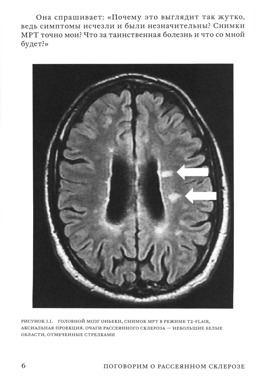 Поговорим о рассеянном склерозе: Семь шагов к преодолению болезни