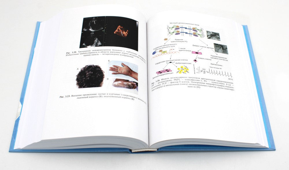 Кардиомиопатии и миокардиты. 2-е изд., перераб. и доп