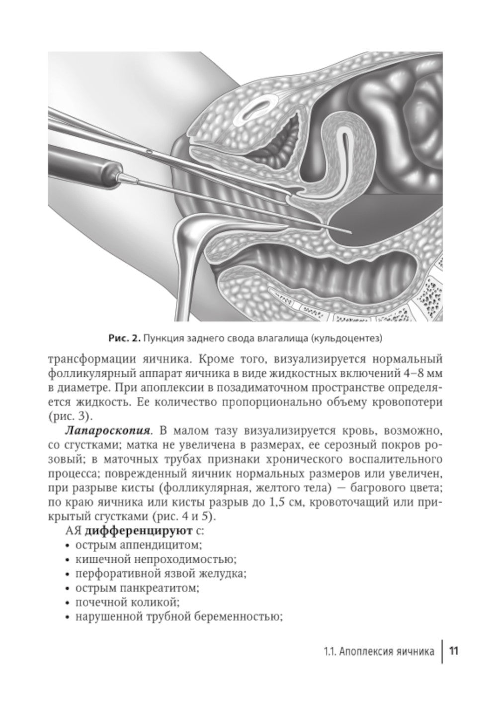 Острый живот в гинекологии: руководство для врачей