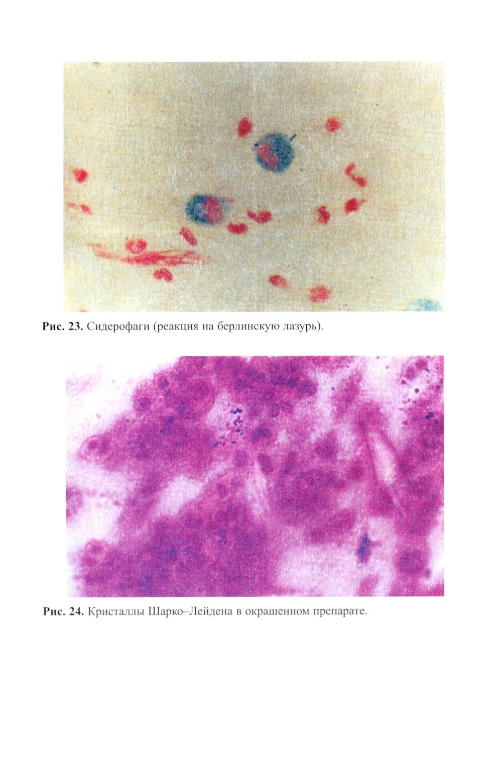 Клиническая лабораторная диагностика (методы и трактовка лабораторных исследо...