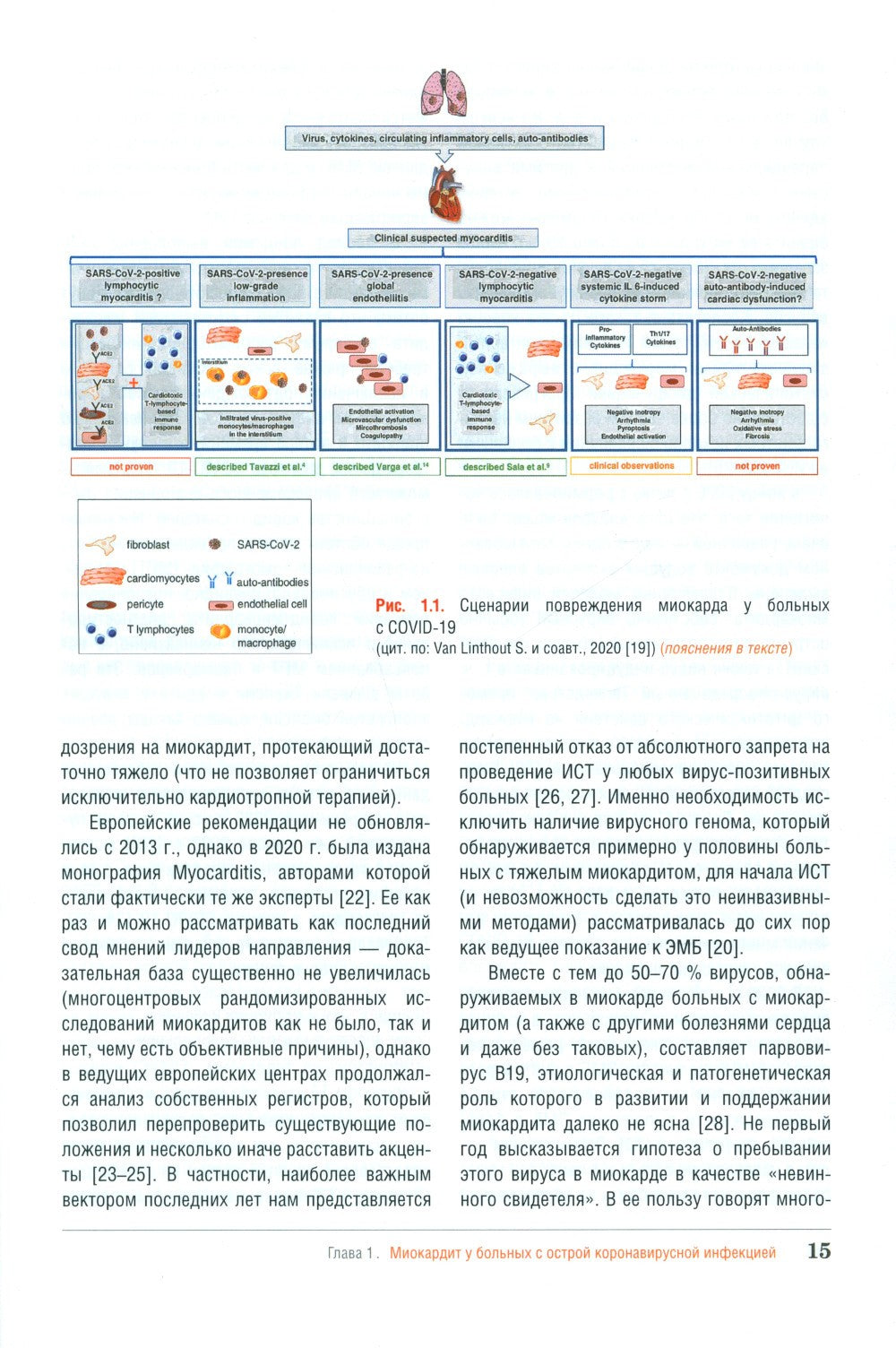Миокардит в период пандемии SARS-CoV-2