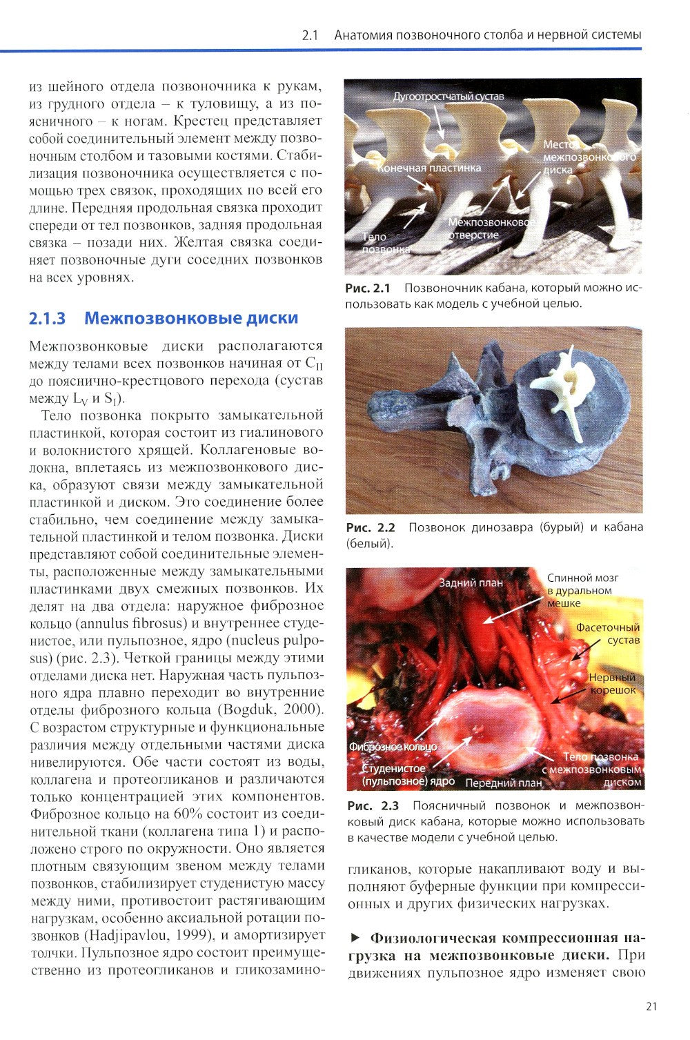 Диагностика и лечение поражений межпозвонковых дисков. Физическая терапия в н...