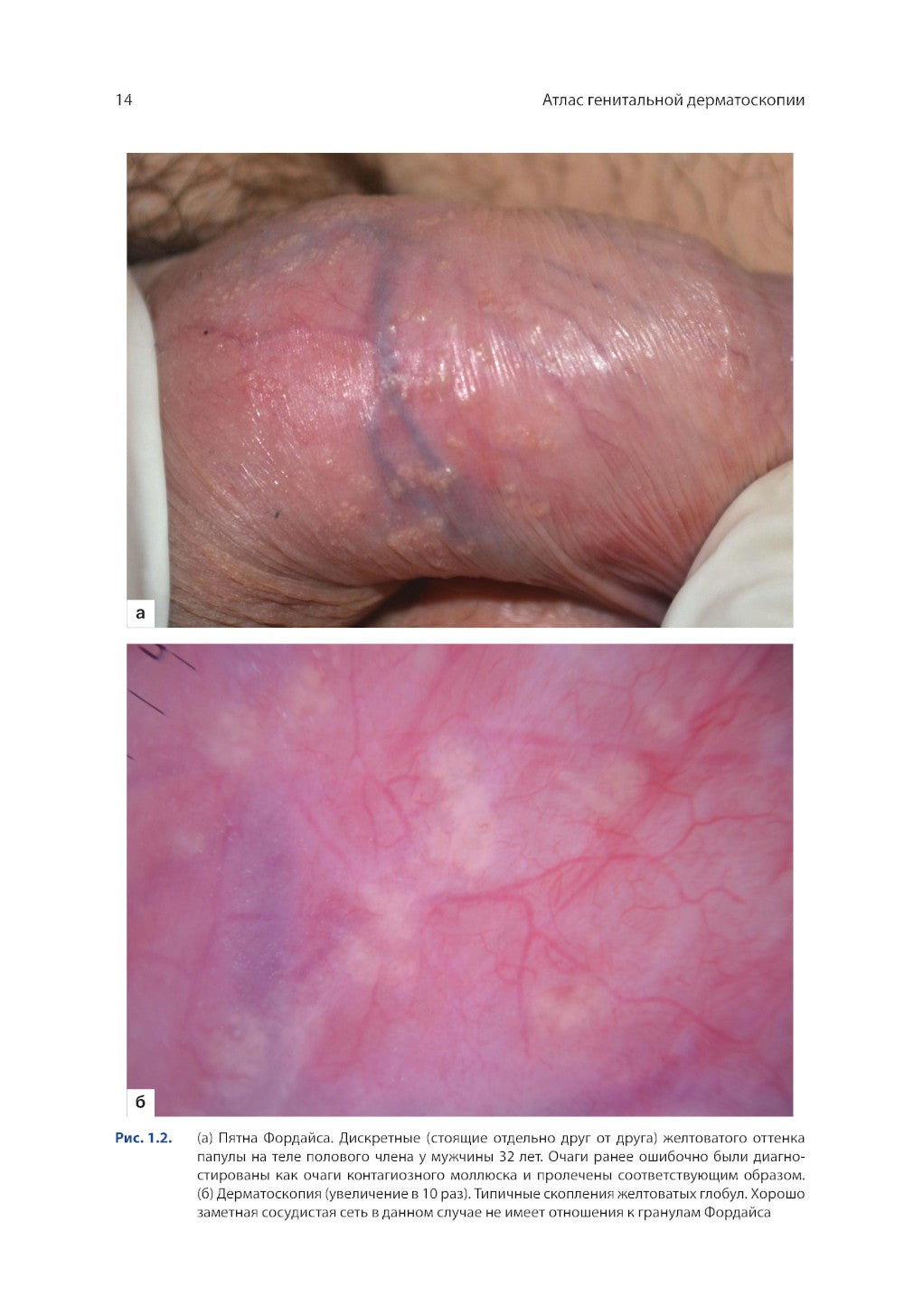 Атлас генитальной дерматоскопии