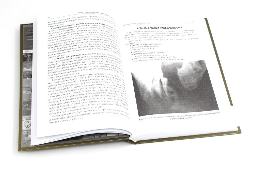 Военная стоматология и челюстно-лицевая хирургия: Учебное пособие. 3-е изд., ...