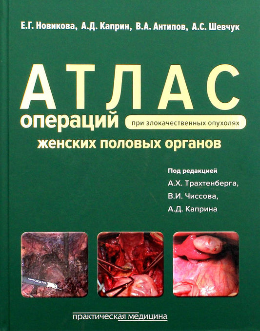 Атлас операций при злокачественных опухолях женских половых органов