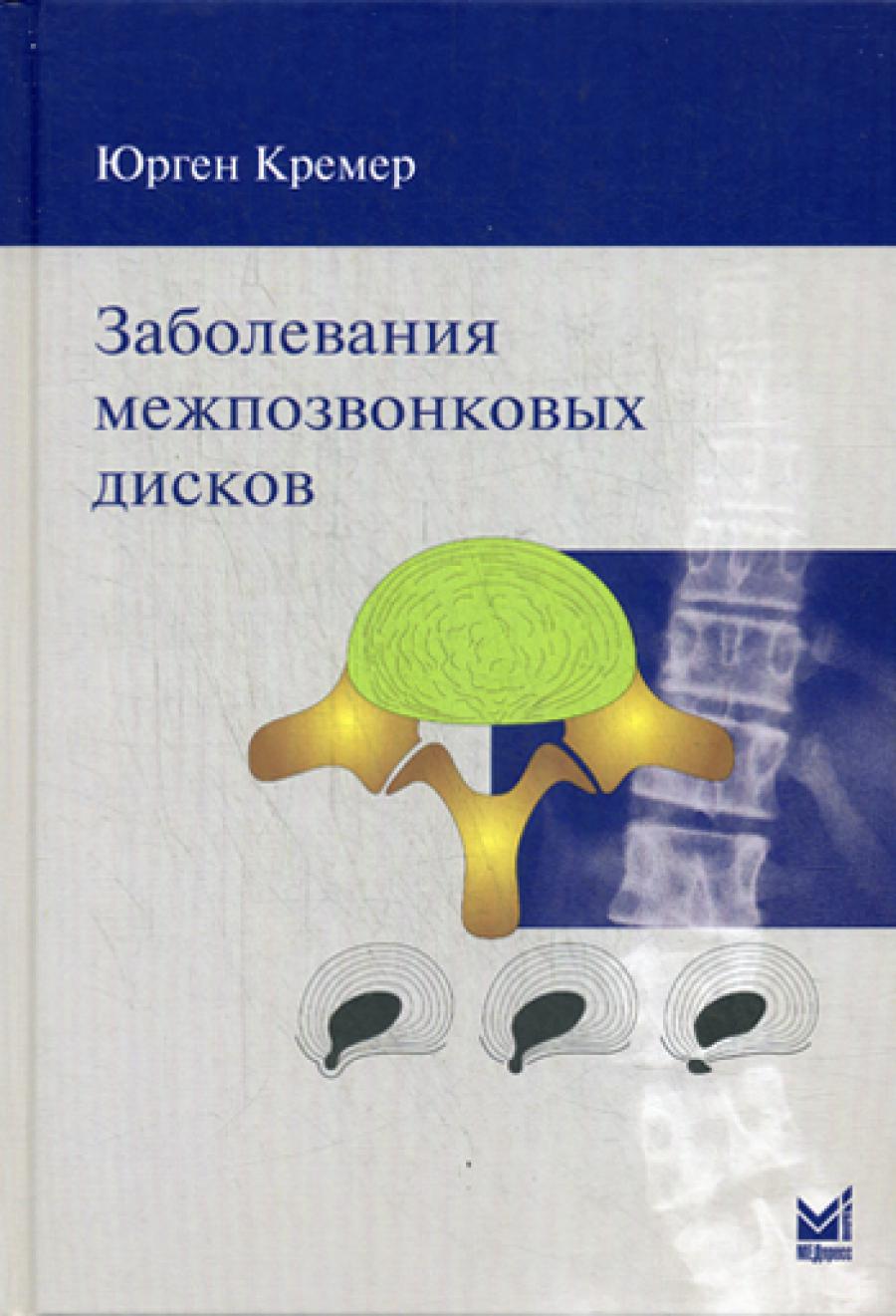 Заболевания межпозвонковых дисков. 2-е изд