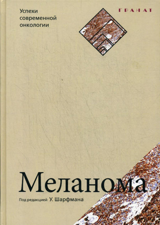 Mélanome. Успехи современной онкологии